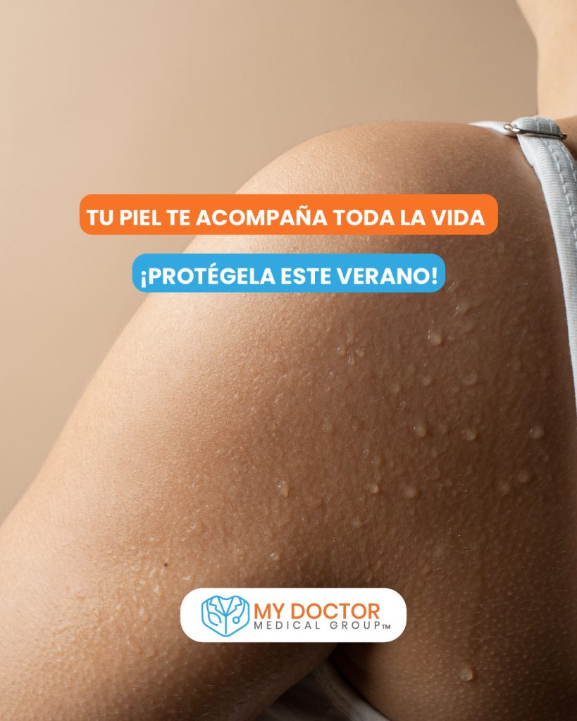 proteger tu piel